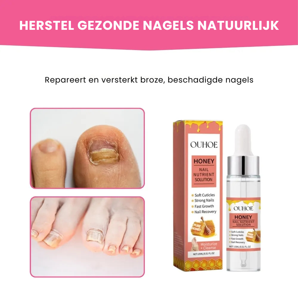 NailSoothe® | Natuurlijke Honingformule voor Gezonde Nagels NL