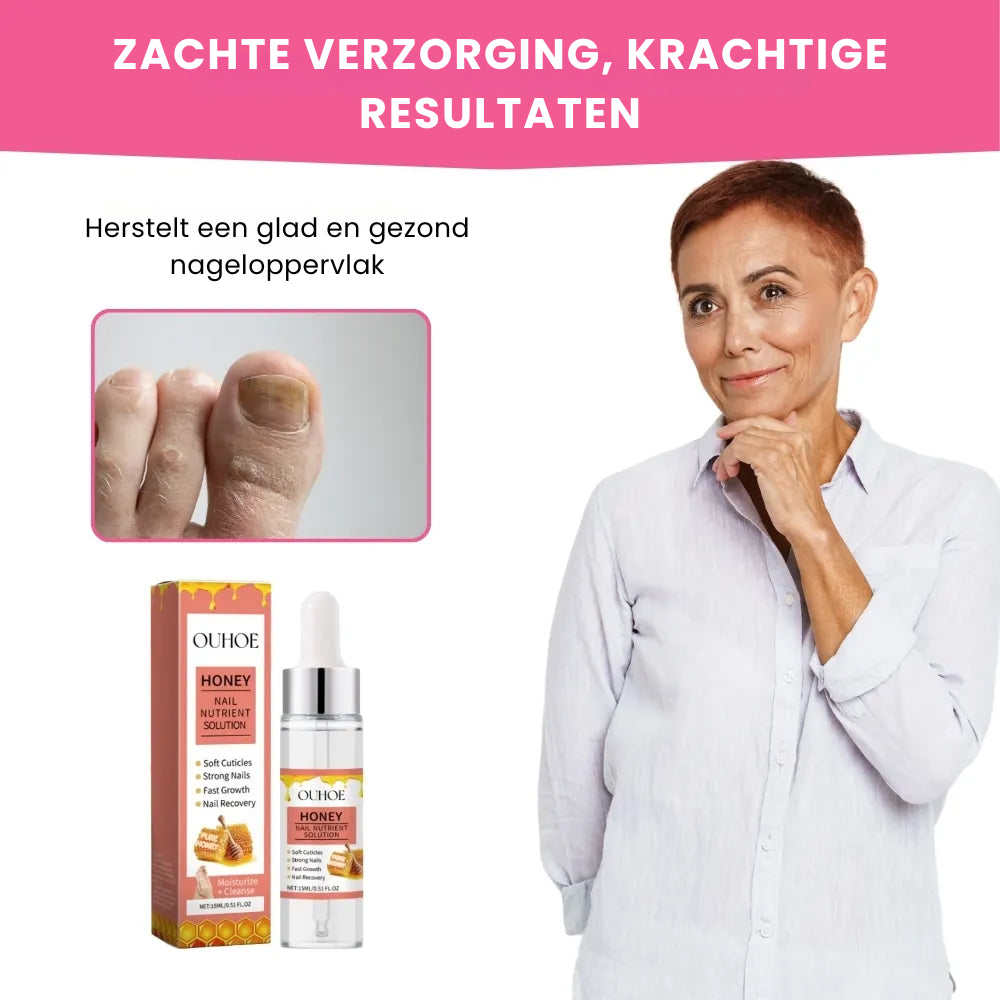 NailSoothe® | Natuurlijke Honingformule voor Gezonde Nagels NL