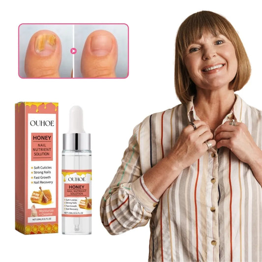 NailSoothe® | Natuurlijke Honingformule voor Gezonde Nagels NL