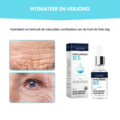 WrinkFree® | Ondersteunt een Gladde en Stralende Huid! NL