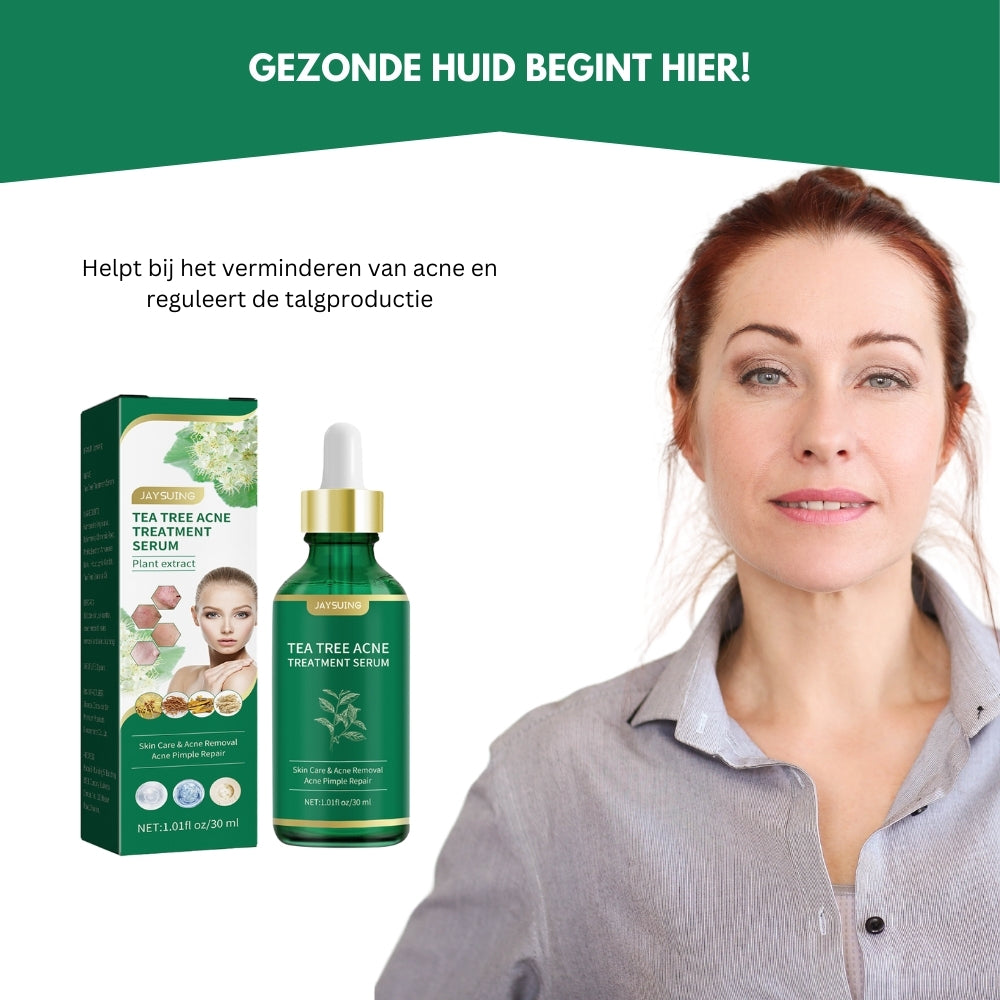 AcneEase® | Natuurlijke Ondersteuning voor een Heldere Huid